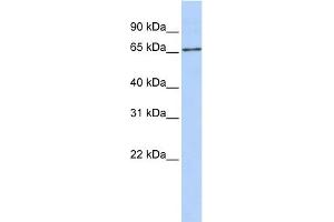 SLC27A6 antibody  (Middle Region)