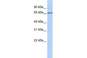 WB Suggested Anti-SLC27A6 Antibody Titration:  0. (SLC27A6 antibody  (Middle Region))