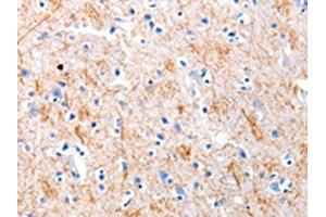 The image on the left is immunohistochemistry of paraffin-embedded Human brain tissue using ABIN7191217(KISS1 Antibody) at dilution 1/5, on the right is treated with synthetic peptide. (KISS1 antibody)