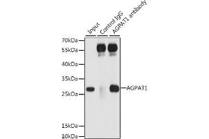 Immunoprecipitation analysis of 200 μg extracts of 293T cells, using 3 μg  antibody (ABIN6132132, ABIN6136638, ABIN6136639 and ABIN6222173). (AGPAT1 antibody  (AA 204-283))