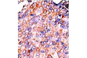 Image no. 2 for anti-Signal Transducer and Activator of Transcription 3 (Acute-Phase Response Factor) (STAT3) (pSer727) antibody (ABIN358233)