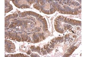 IHC-P Image beta Tubulin 2 antibody detects beta Tubulin 2 protein at cytosol on mouse duodenum by immunohistochemical analysis. (TUBB2A antibody)