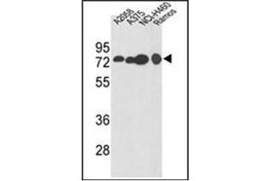 Western blot analysis of HADHA Antibody (C-term) in A2058, A375, NCI-H460, Ramos cell line lysates (35ug/lane).