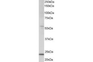 Western Blotting (WB) image for anti-MAX Dimerization Protein 4 (MXD4) (C-Term) antibody (ABIN2465917)