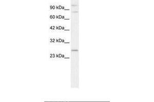 Image no. 1 for anti-Polycomb Group Ring Finger 3 (PCGF3) (AA 103-152) antibody (ABIN202112)