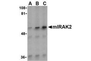Western blot analysis of IRAK2 in A-20 whole cell lysate with AP30440PU-N IRAK2 antibody (C2) at (A) 0. (IRAK2 antibody  (C-Term))