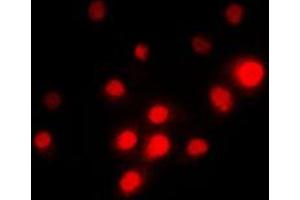 Immunofluorescent analysis of TFE3 staining in PC12 cells. (TFE3 antibody  (Center))