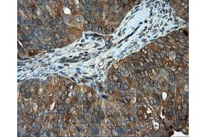 Immunohistochemical staining of paraffin-embedded Kidney tissue using anti-RC201933 mouse monoclonal antibody.