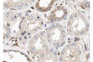 ABIN6274004 at 1/100 staining Human kidney tissue by IHC-P. (CUBN antibody  (N-Term))