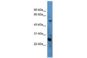 Western Blot showing C1QA antibody used at a concentration of 1-2 ug/ml to detect its target protein. (C1QA antibody  (N-Term))