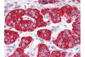 Immunohistochemistry (Paraffin-embedded Sections) (IHC (p)) image for anti-Prostaglandin D2 Receptor 2 (PTGDR2) (N-Term) antibody (ABIN615056)
