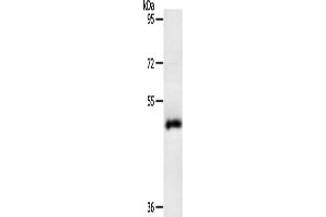 Gel: 10 % SDS-PAGE, Lysate: 40 μg, Lane: Human liver cancer tissue, Primary antibody: ABIN7131158(SPATA17 Antibody) at dilution 1/200, Secondary antibody: Goat anti rabbit IgG at 1/8000 dilution, Exposure time: 10 minutes (SPATA17 antibody)
