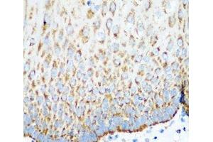Immunohistochemistry of paraffin-embedded Human esophagus using MTCO2 Polyclonal Antibody at dilution of 1:100 (40x lens). (COX2 antibody)