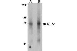 Western blot analysis of FNIP2 in mouse skeletal muscle lysate with AP30346PU-N FNIP2 antibody at (A) 1 and (B) 2 μg/ml.