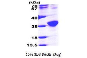 SDS-PAGE (SDS) image for RAB6A, Member RAS Oncogene Family (RAB6A) (AA 1-208) protein (His tag) (ABIN667298)