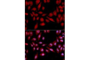 Immunofluorescence analysis of U2OS cells using PSMA2 antibody. (PSMA2 antibody  (AA 1-234))