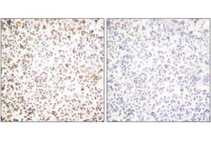 Immunohistochemistry analysis of paraffin-embedded human lymph node tissue, using OCT1 Antibody. (POU2F1 antibody  (AA 41-90))