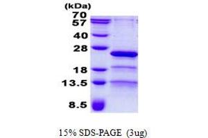 Image no. 1 for Retinitis Pigmentosa 9 (Autosomal Dominant) (RP9) protein (His tag) (ABIN1098481)
