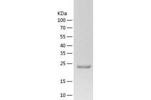 Western Blotting (WB) image for ZW10 Interactor (ZWINT) (AA 1-230) protein (His tag) (ABIN7284722) (ZWINT Protein (AA 1-230) (His tag))