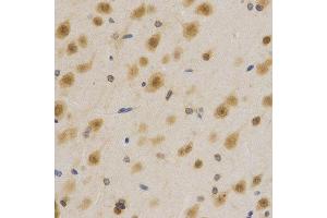 Immunohistochemistry (IHC) image for anti-ELAV (Embryonic Lethal, Abnormal Vision, Drosophila)-Like 1 (Hu Antigen R) (ELAVL1) (AA 1-326) antibody (ABIN3022231)