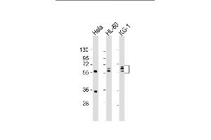 All lanes : Anti-FGL2 Antibody (C-term) at 1:2000 dilution Lane 1: Hela whole cell lysate Lane 2: HL-60 whole cell lysate Lane 3: KG-1 whole cell lysate Lysates/proteins at 20 μg per lane.