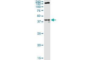 OPRM1 polyclonal antibody (A01). (Mu Opioid Receptor 1 antibody  (AA 1-110))