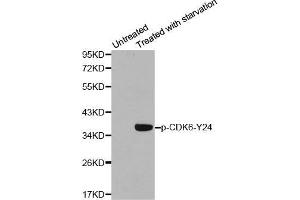 Western blot analysis of extracts from 293 cells using Phospho-CDK6-Y24 antibody. (CDK6 antibody  (pTyr24))