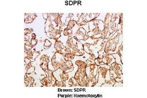 Sample Type :  Human placental tissue   Primary Antibody Dilution :   1:50  Secondary Antibody :  Goat anti rabbit-HRP   Secondary Antibody Dilution :   1:10,000  Color/Signal Descriptions :  Brown: SDPR Purple: Haemotoxylin  Gene Name :  Sdpr  Submitted by :  Dr. (SDPR antibody  (N-Term))
