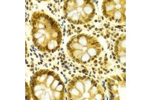 Immunohistochemistry (Paraffin-embedded Sections) (IHC (p)) image for anti-ELAV (Embryonic Lethal, Abnormal Vision, Drosophila)-Like 1 (Hu Antigen R) (ELAVL1) (AA 1-326) antibody (ABIN3022231)