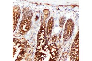 Anti-Hsc70 antibody, IHC(F) IHC(F): Rat Intestine Tissue (Hsc70 antibody  (N-Term))