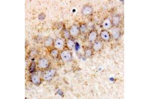 Immunohistochemical analysis of HSPA6 staining in rat brain formalin fixed paraffin embedded tissue section.
