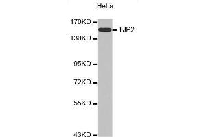Western Blotting (WB) image for anti-Tight Junction Protein 2 (Zona Occludens 2) (TJP2) (AA 951-1190) antibody (ABIN6213898) (TJP2 antibody  (AA 951-1190))