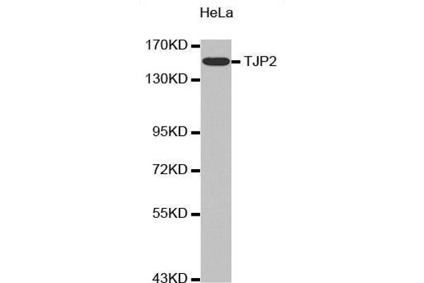 TJP2 Antikörper  (AA 951-1190)