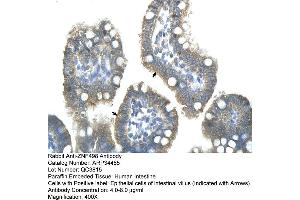 Human Intestine (Zinc Finger and SCAN Domain Containing 25 (ZSCAN25) (Middle Region) antibody)
