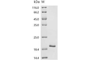 Leukocyte Cell-Derived Chemotaxin 2 (LECT2) (AA 19-151), (full length) protein (His tag)