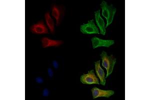 ABIN6261462 and ABIN6269075 staining Hela cells by IF/ICC. (EGFR antibody  (C-Term))