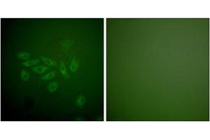 Immunofluorescence analysis of A549 cells, using FHIT antibody (ABIN5976398). (FHIT antibody  (Internal Region))