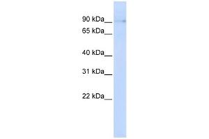 WB Suggested Anti-ZCCHC14 Antibody Titration: 0. (ZCCHC14 antibody  (N-Term))