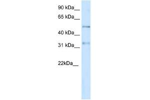 KCNAB2 antibody used at 1 ug/ml to detect target protein. (KCNAB2 antibody  (Middle Region))