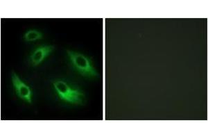 Immunofluorescence analysis of HeLa cells, using EPHB6 Antibody. (EPH Receptor B6 antibody  (AA 861-910))