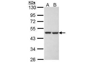 WB Image Sample (30 ug of whole cell lysate) A: H1299 B: Hela 10% SDS PAGE antibody diluted at 1:1000 (KRR1 antibody)