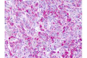Anti-GPR139 antibody IHC of human adrenal medulla. (GPR139 antibody  (Cytoplasmic Domain))