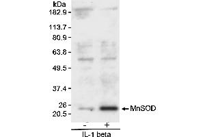 Western Blotting (WB) image for anti-Superoxide Dismutase 2, Mitochondrial (SOD2) (AA 75-125) antibody (ABIN7449177)