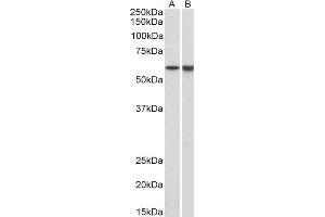 ABIN2563651 (1µg/ml) staining of Pig Bone Marrow (A) and Spleen (B) lysates (35µg protein in RIPA buffer). (LCK antibody  (AA 39-52))