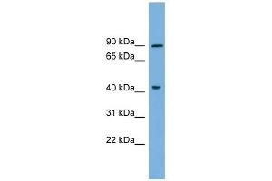 DYRK1A antibody used at 1 ug/ml to detect target protein.
