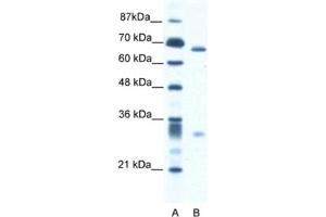 Western Blotting (WB) image for anti-Set1/Ash2 Histone Methyltransferase Complex Subunit ASH2 (ASH2L) antibody (ABIN2460893) (ASH2L antibody)