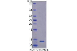 SDS-PAGE analysis of Pig Diamine Oxidase Protein.