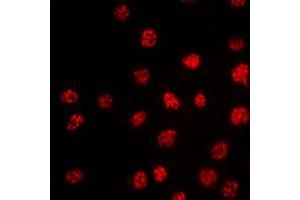 Immunofluorescent analysis of TBX15/18 staining in HepG2 cells. (T-Box 15/18 antibody  (Center))
