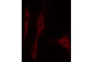 ABIN6274708 staining HepG2 cells by IF/ICC.