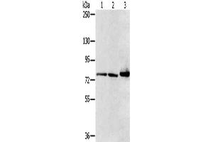 Gel: 6 % SDS-PAGE, Lysate: 40 μg, Lane 1-3: Mouse heart tissue, HT29 cells, mouse liver tissue, Primary antibody: ABIN7128752(CAPN7 Antibody) at dilution 1/300, Secondary antibody: Goat anti rabbit IgG at 1/8000 dilution, Exposure time: 1 second